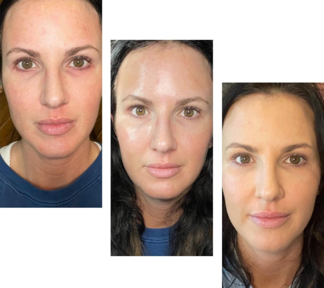 Collage of three women with different skin textures and appearances, each with brown eyes and dark hair.