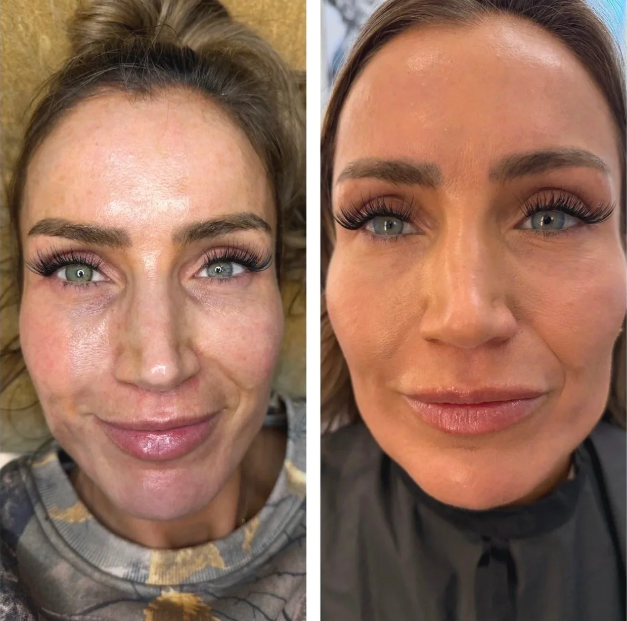 Comparison of a woman before and after beauty treatment, showing improved skin and makeup.