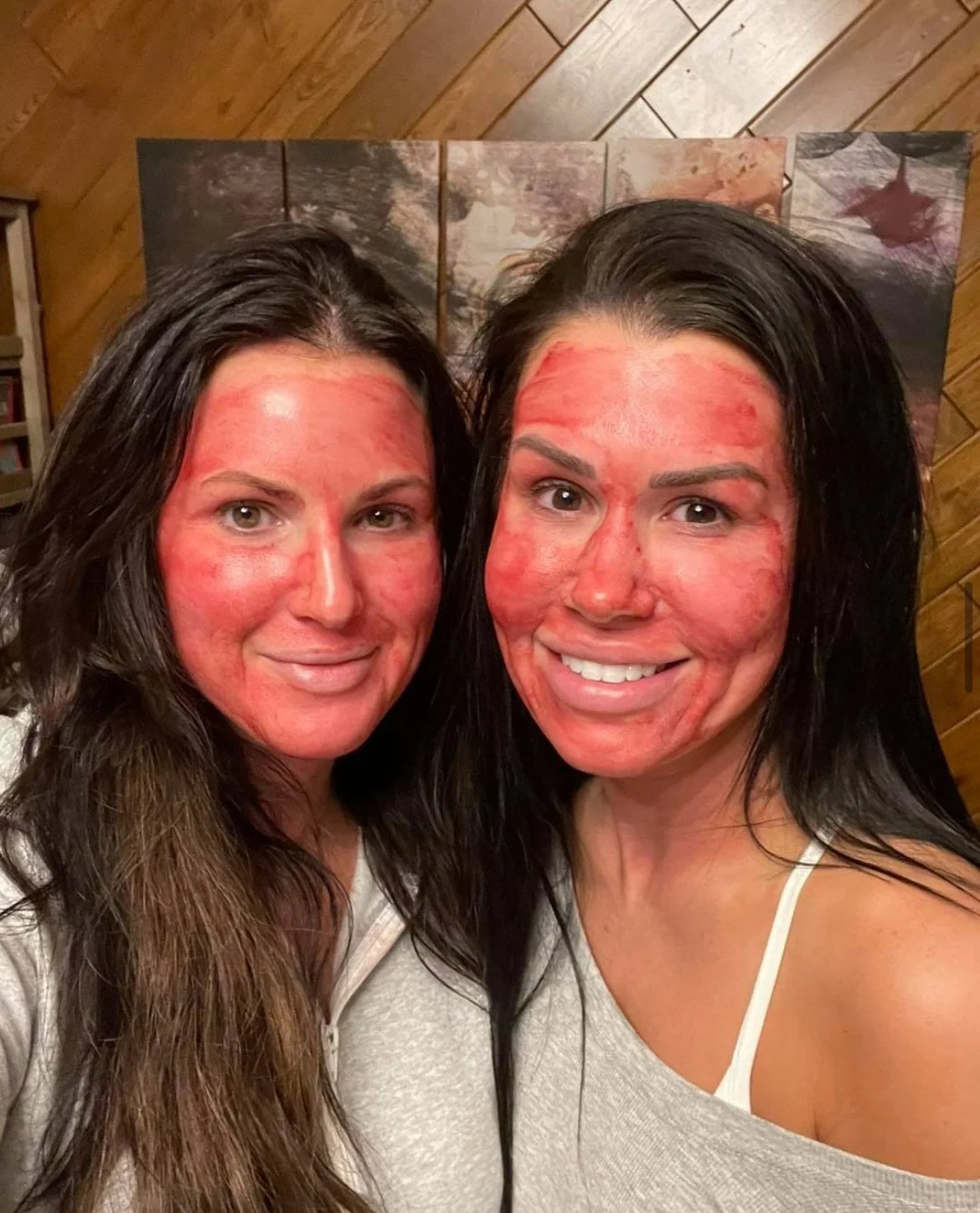 Two women with red, sunburned faces smiling for a selfie indoors with a wood-paneled wall and a painting in the background.