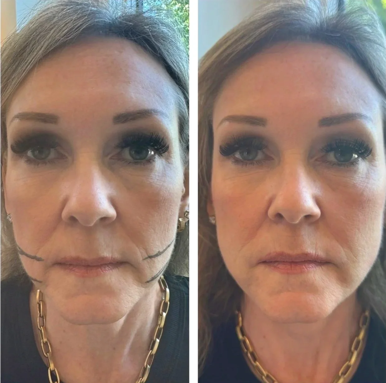 Side-by-side comparison of a woman with makeup, showing before and after facial enhancements, including smoother skin and fuller lips.