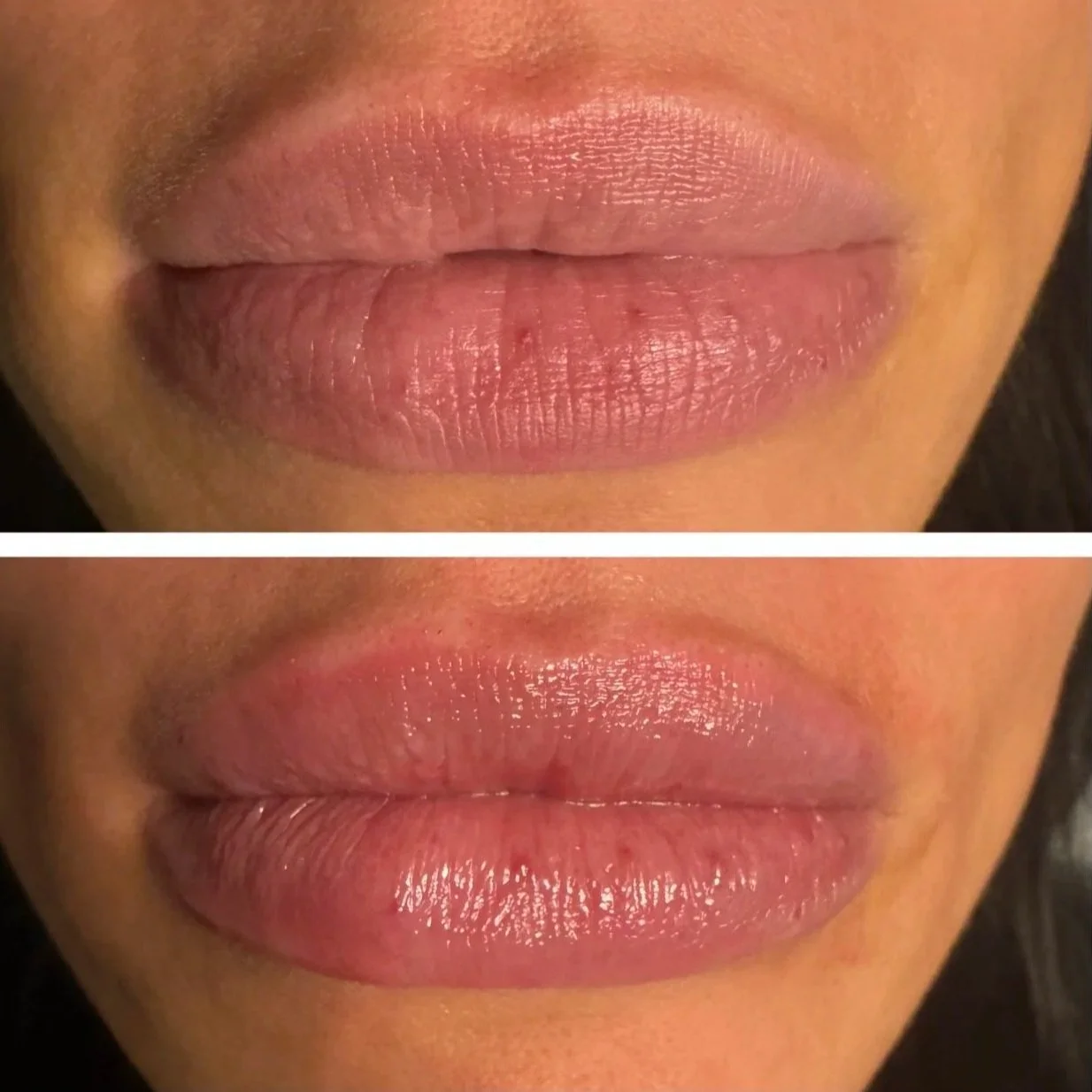 Close-up of lips in a before-and-after comparison, showing increased moisture and shine in the after image.