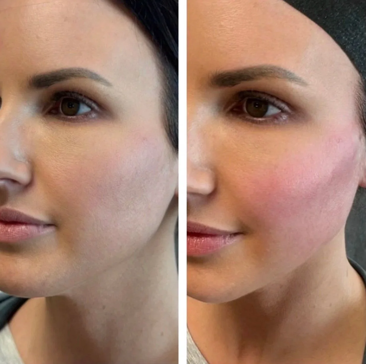 Close-up side-by-side comparison of a woman's face showing the difference before and after applying makeup, with smoother skin and enhanced features in the after image.