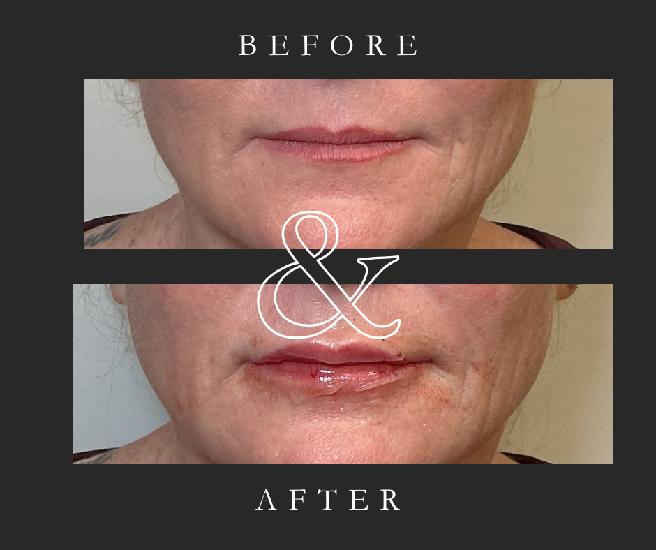 Black Modern Before and After Beauty Lash Tech Facebook Post.PNG