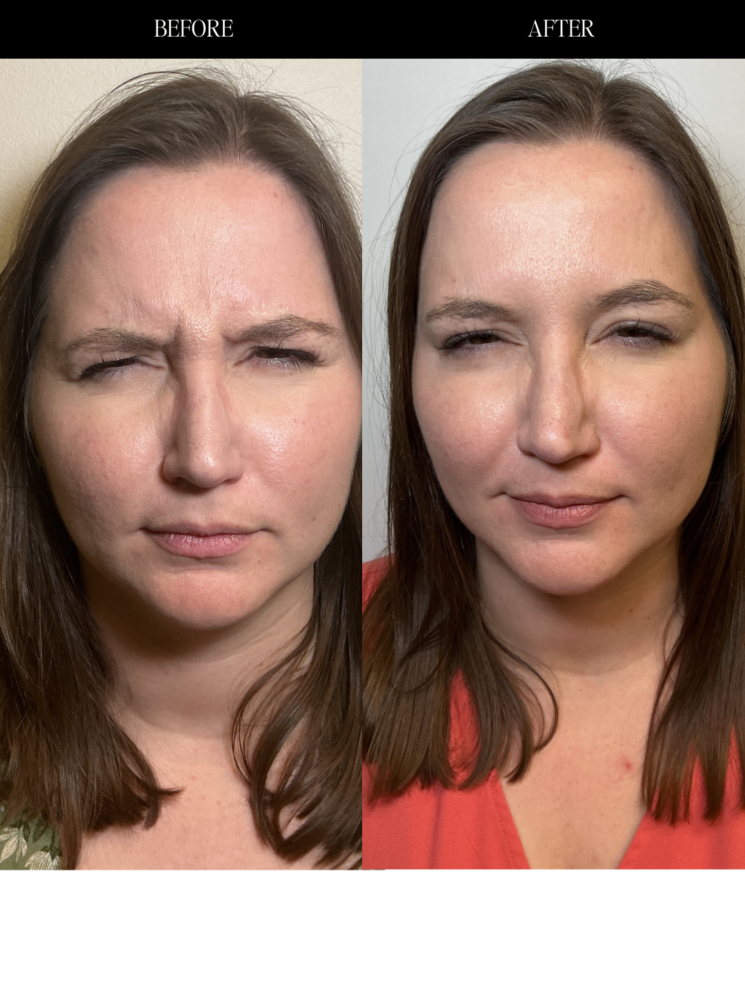 Copy of Before and Afters (NEW Portrait Size) (1).png