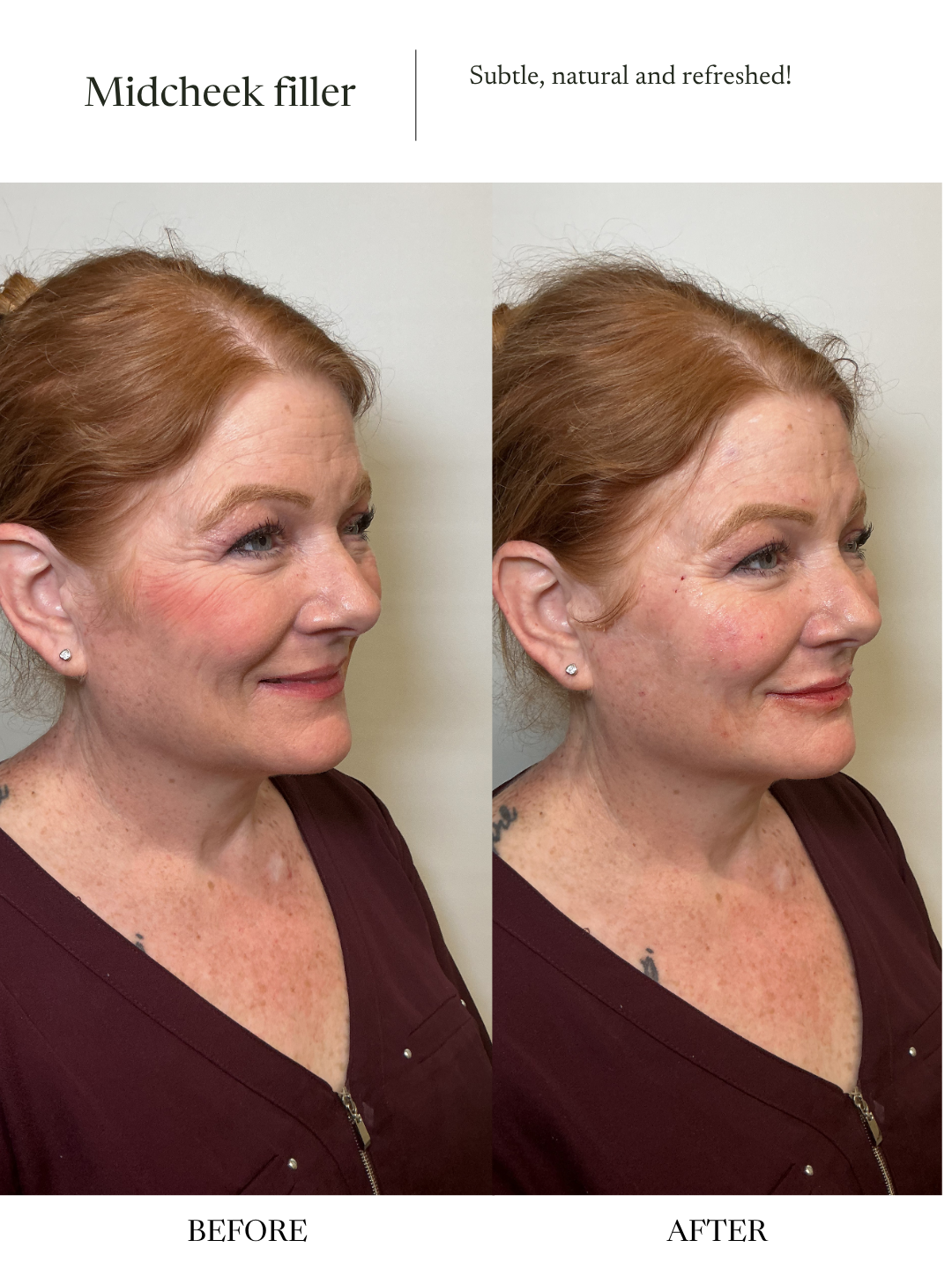 Copy of Before and Afters (NEW Portrait Size) - 5.PNG