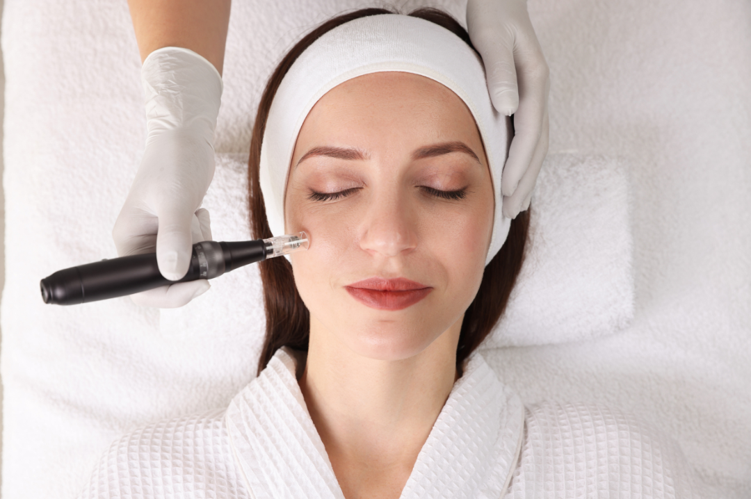 Medspa in Summerville, SC, 29485 | Microneedling Near Me
