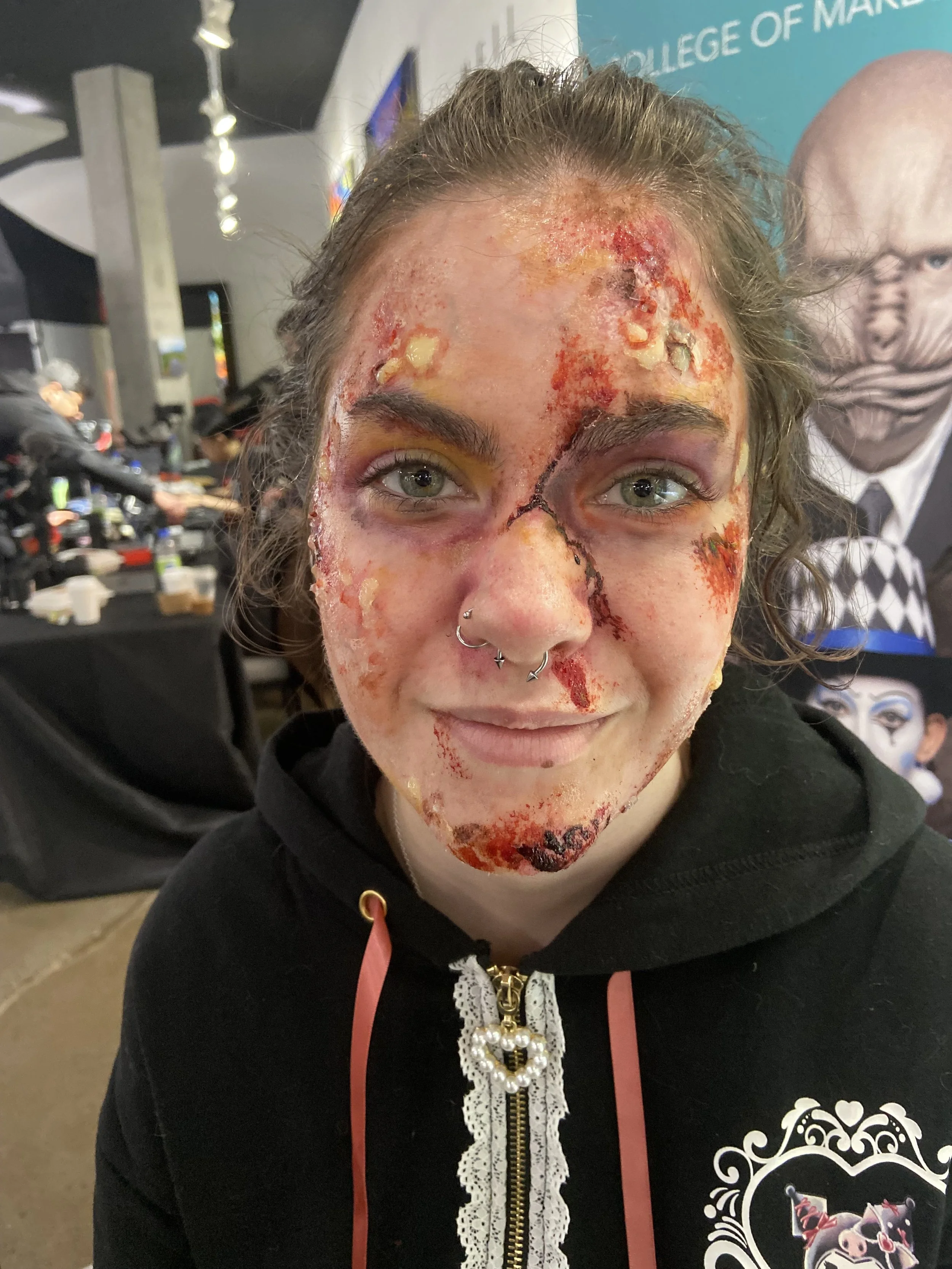 A young woman with medical makeup resembling severe burns or injuries on her face, nose, and forehead, with fake blood and prosthetics, smiling in an indoor setting at a themed event or costume party.