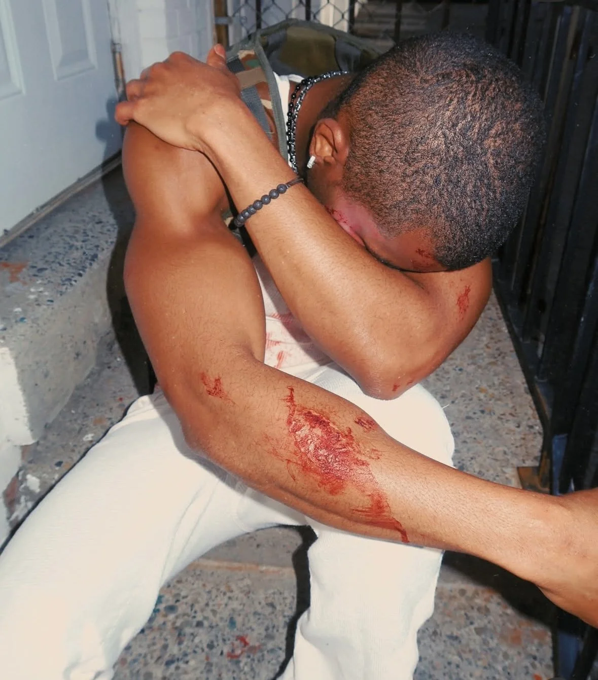 A young man with short hair and earrings sitting on the ground, covering his face with his arms, showing multiple fresh bloodied cuts on his face and arms.