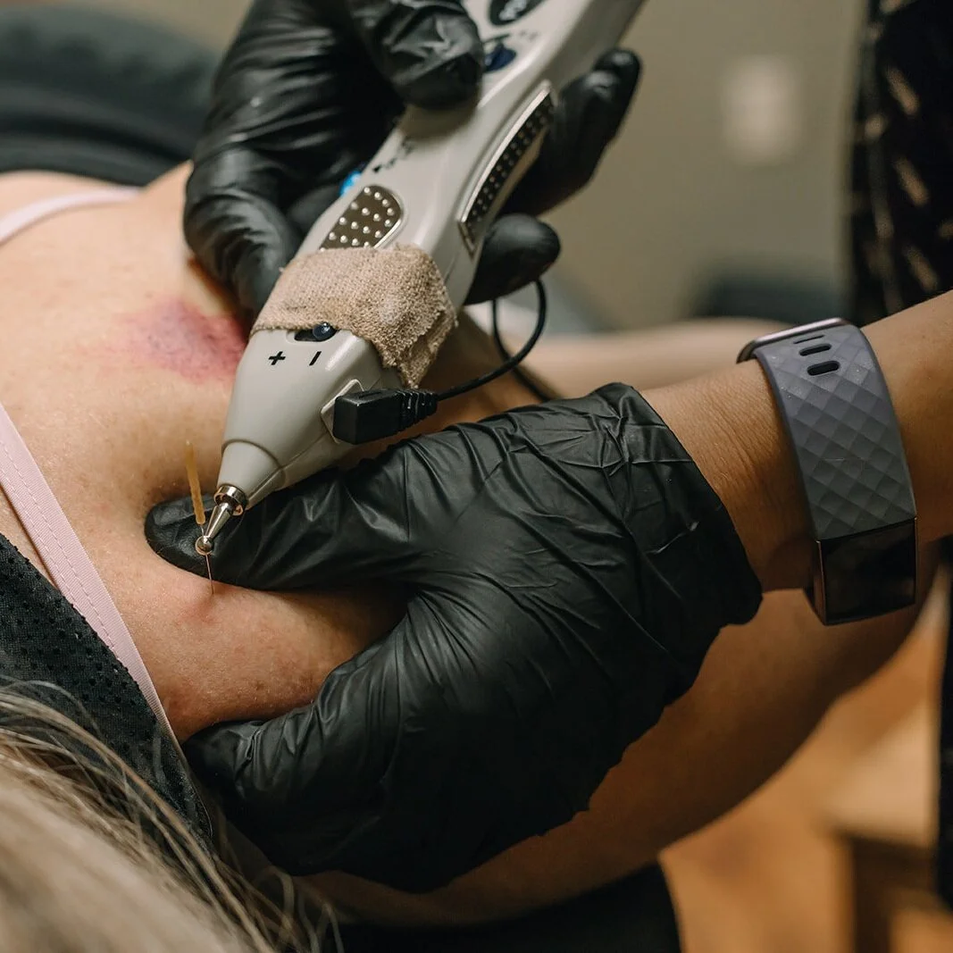 A healthcare professional with black gloves is drawing blood from a patient's arm using a needle and a blood collection device in a clinical setting.