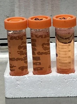 LWRN Conditioned Media