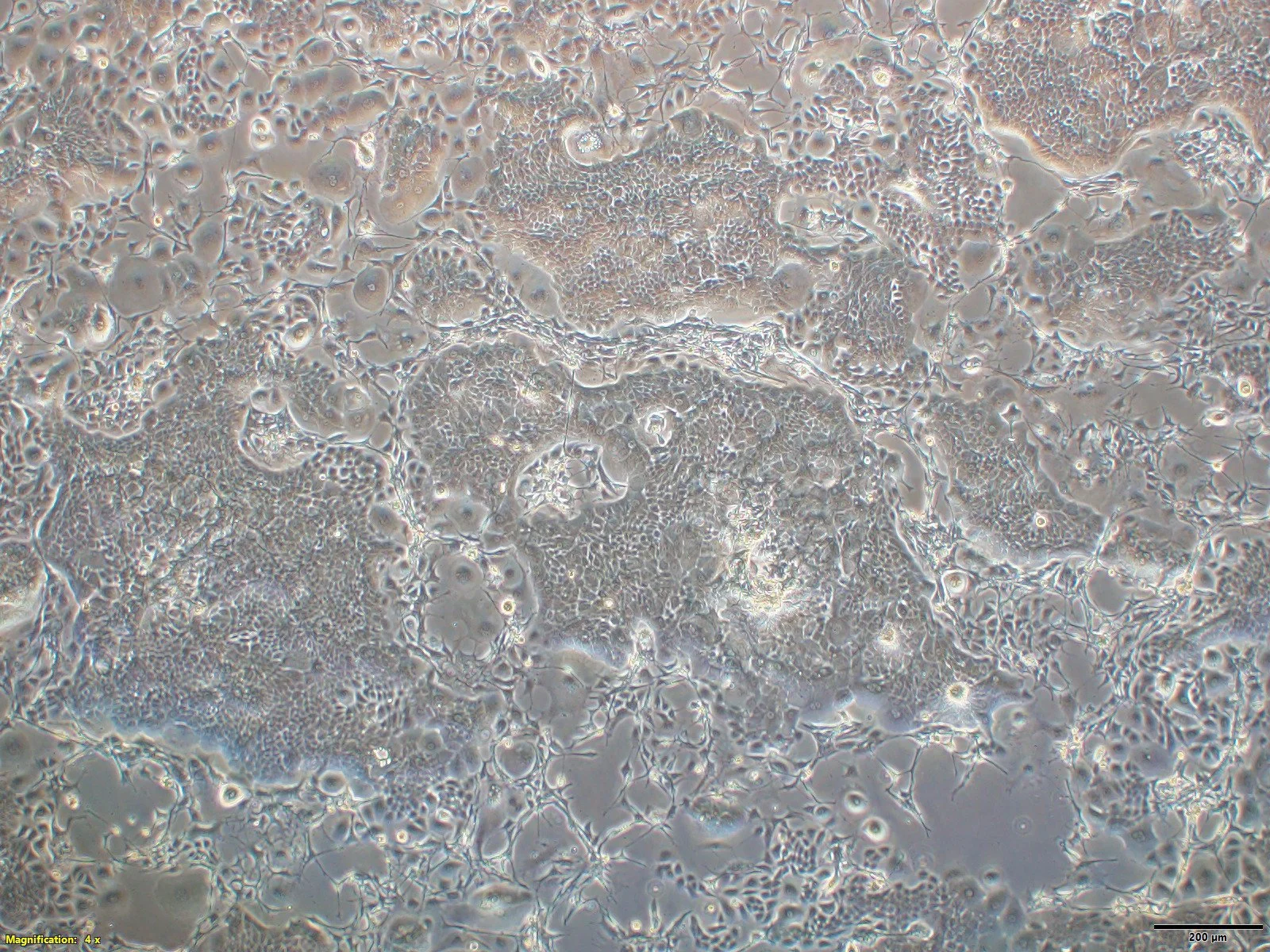 PDO Monolayer requiring Feeder Cells