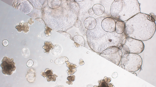 Patient Derived Organoids (PDO)