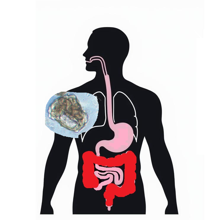 IGF1/FGF2 Budding HCM