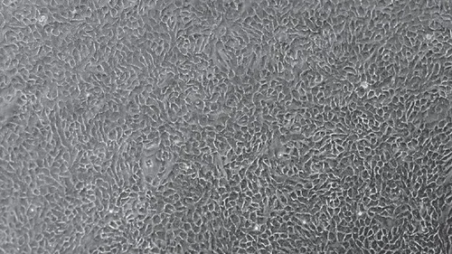 Colonoid/Enteroid Monolayer