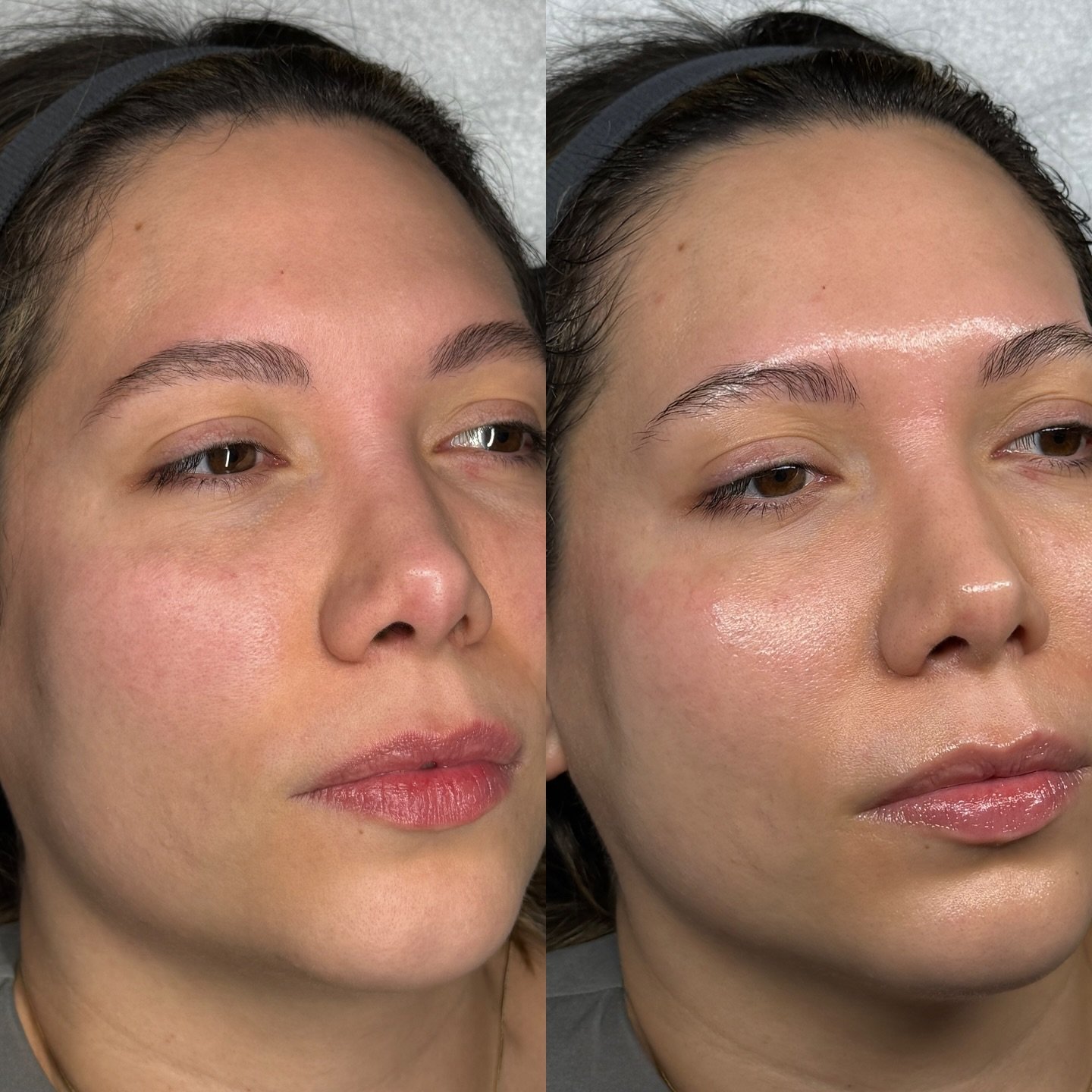 This could be YOU!! ✨👀 

_______________________
HydroDiamond facial 
Diamond Facial 
Hydrodermabrasion Facial in Columbus Ohio
Anti-aging Facial 
Facials in Columbus Ohio
Deep Pore Facial