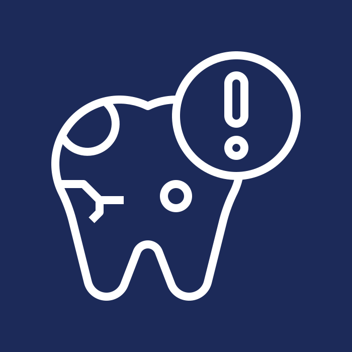 Cracked Teeth Management