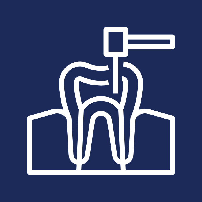 Amalgam (Mercury) Filling Replacement