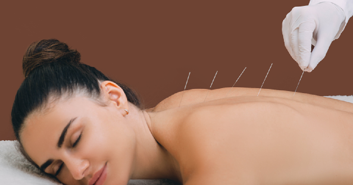 What to Expect During Your First Acupuncture Session