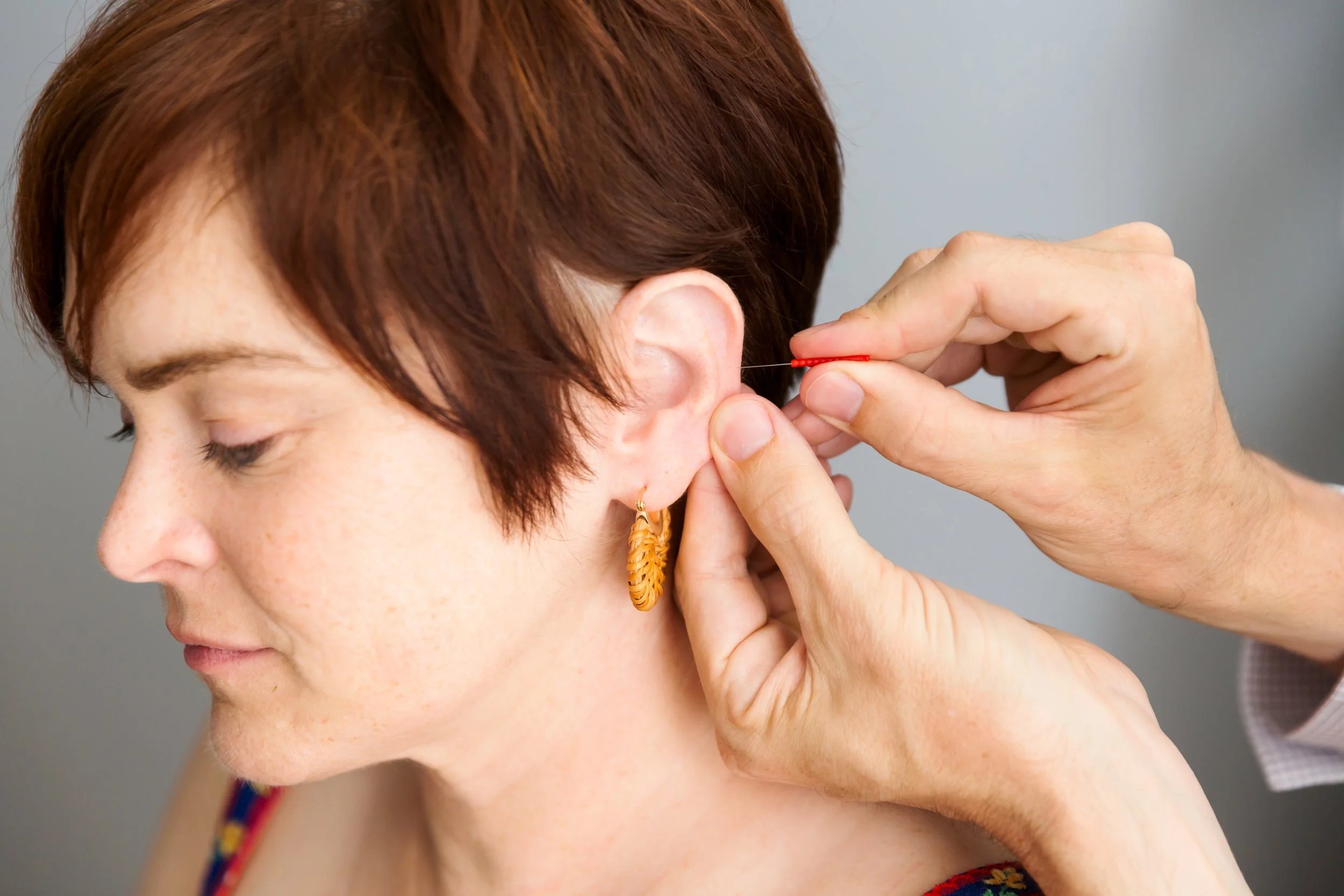 Healing Trauma Through Acupuncture: A Gentle Path to Recovery