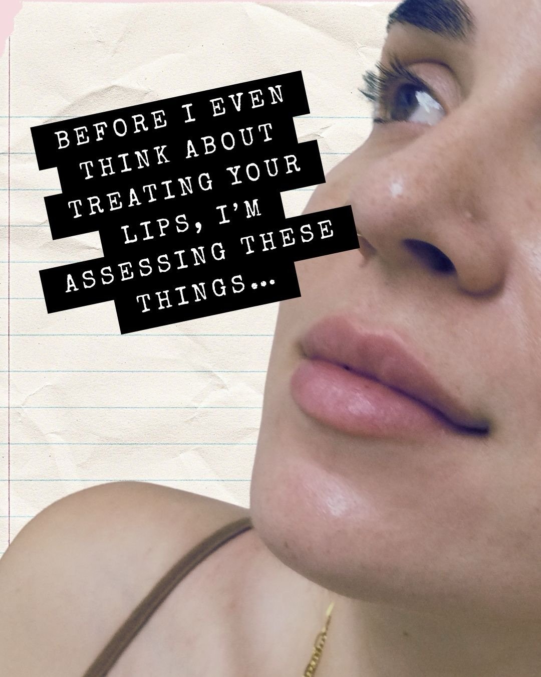 Thinking about lip treatment? 👄

Let&rsquo;s start with a consultation.

I&rsquo;ll assess your anatomy, discuss your goals, and determine the best approach for natural-looking results that suit you.

📲 DM me to book your consultation 

Kristen | R