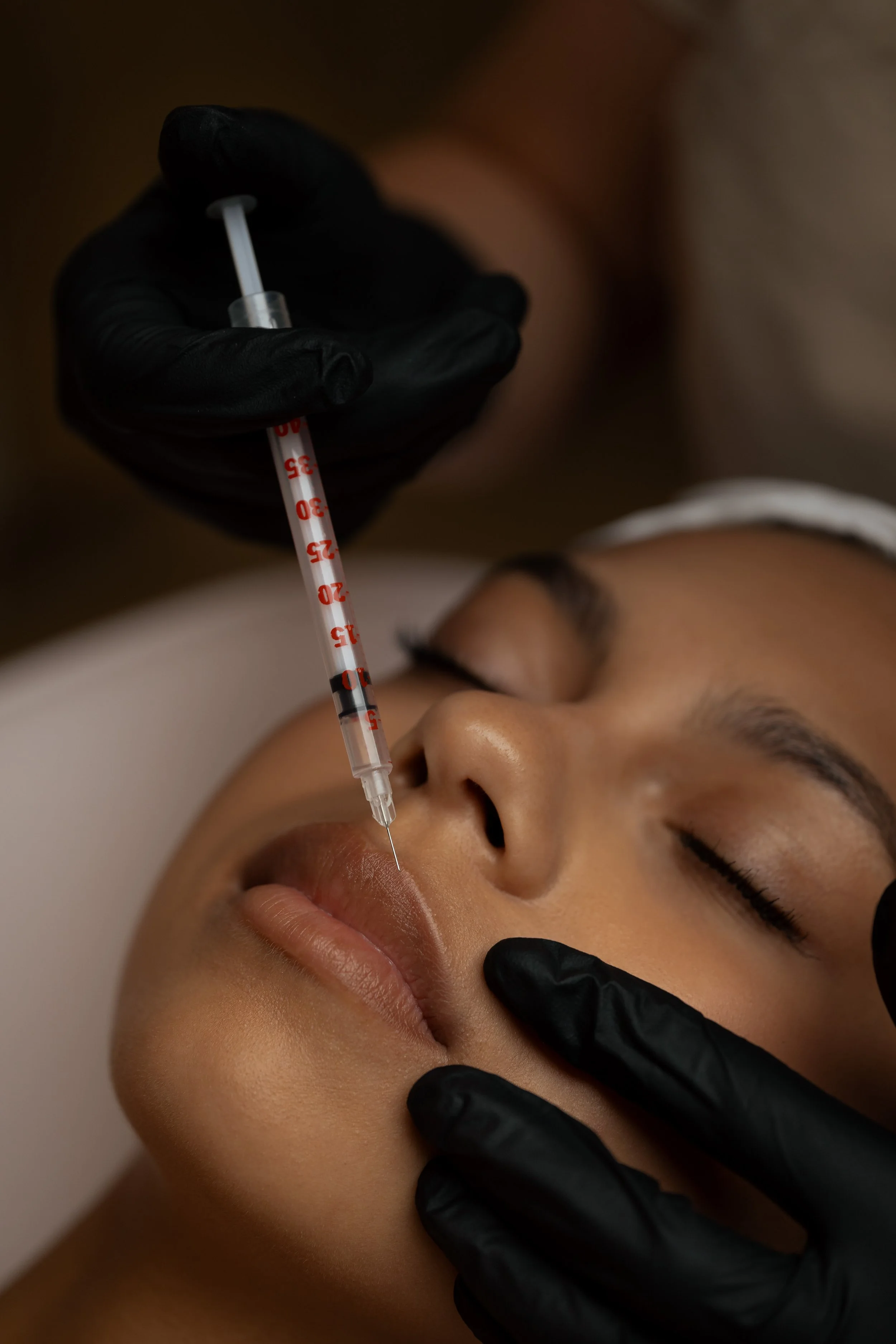 Person receiving a cosmetic or skincare injection in their face, with hands in black gloves holding a syringe.