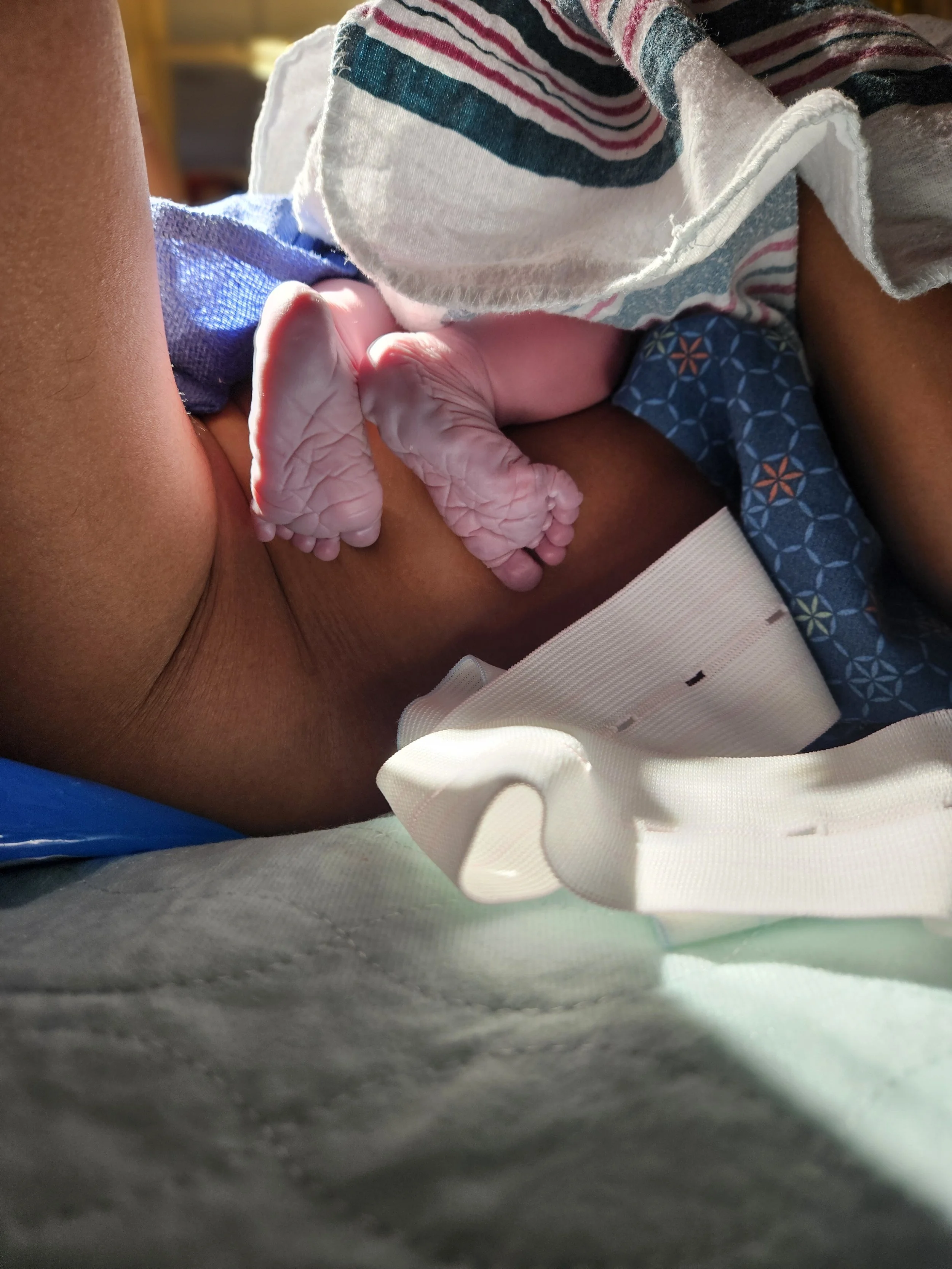 Close-up of a newborn baby's feet, lying on a person's chest during birth, with a hospital strap visible.