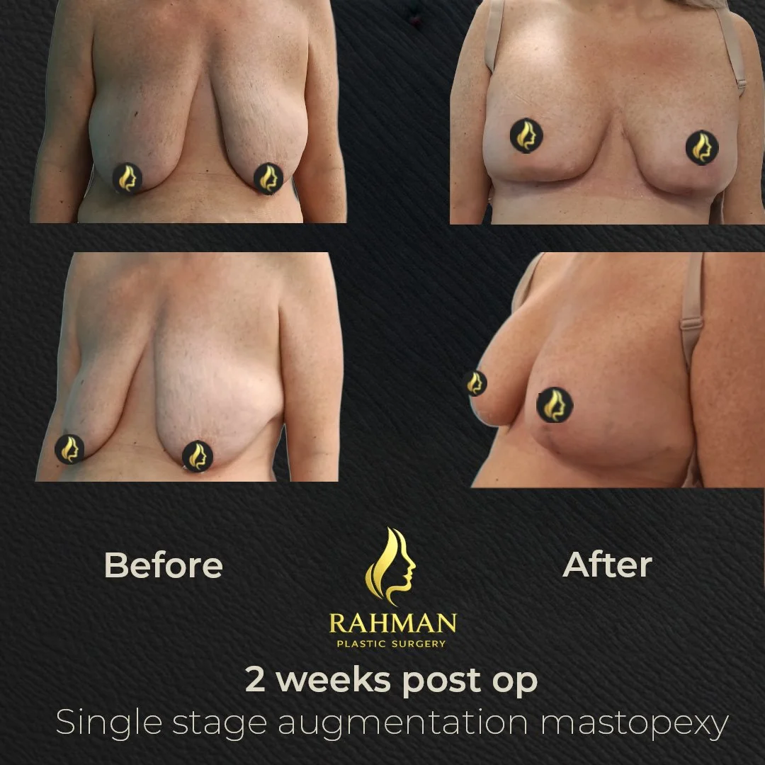 2 weeks Op Aug Mast 2.jpg