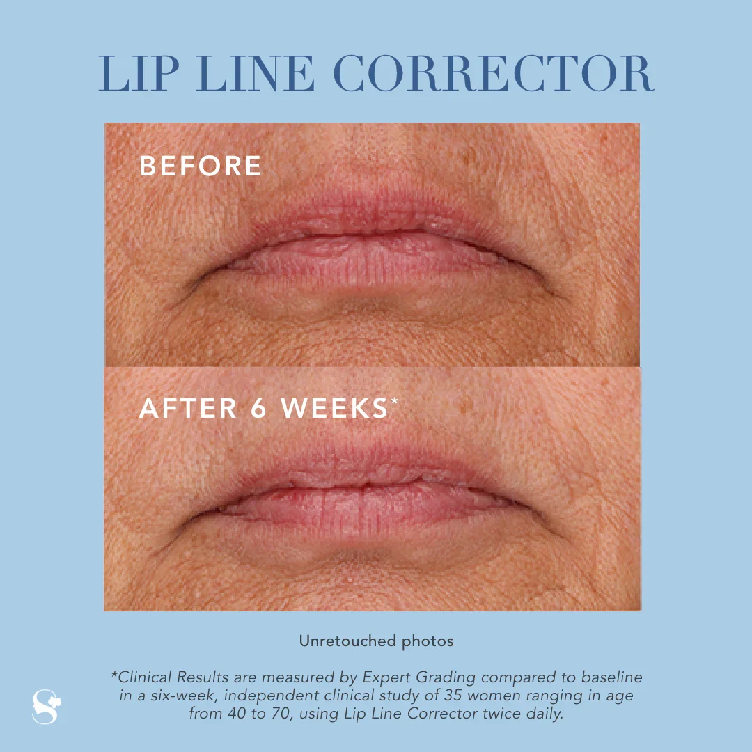 LIPLINE ORRECTOR RESULTS.webp