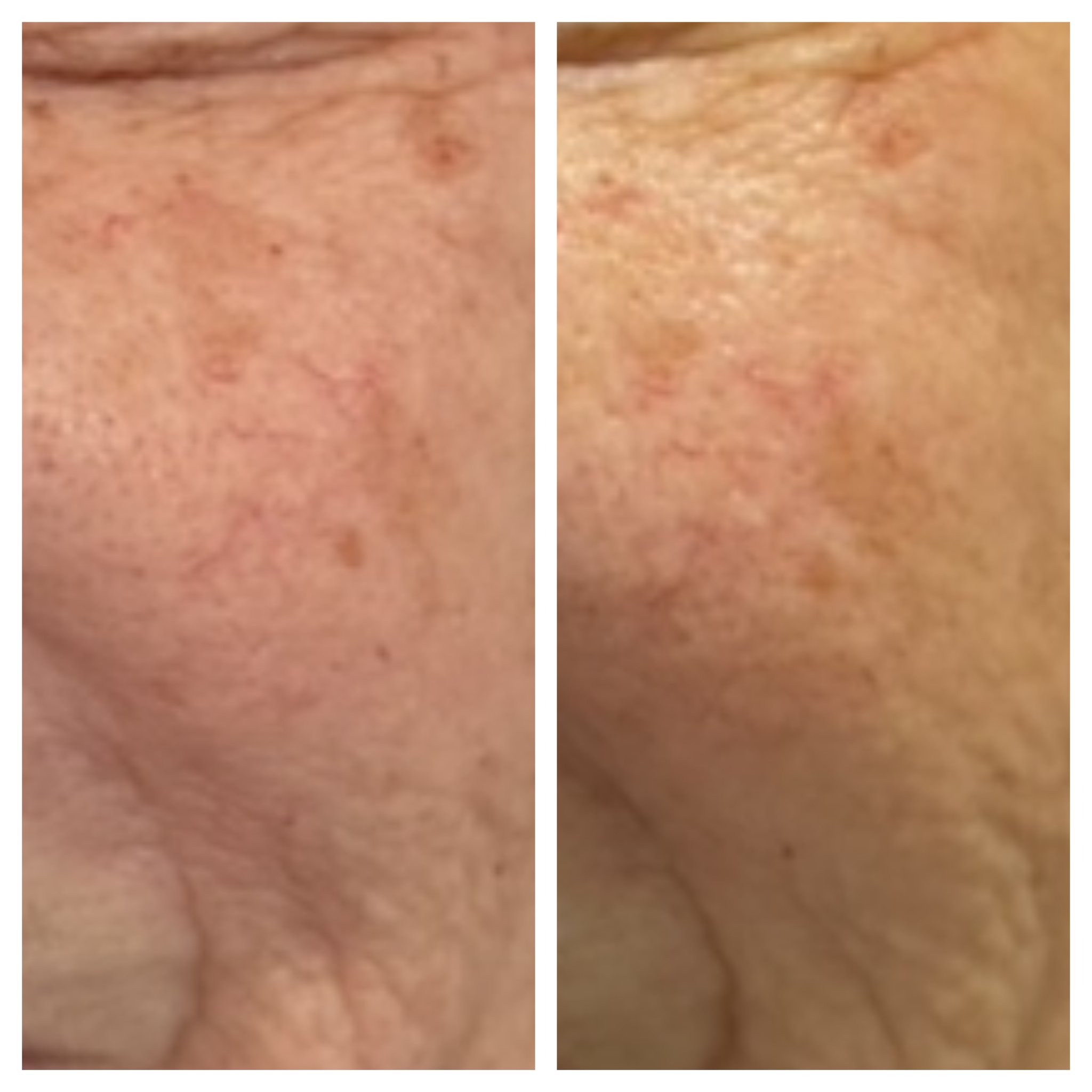 Revalis Aesthetics Medspa in Peoria, AZ, 85381 Botox, Fillers, Weight Loss