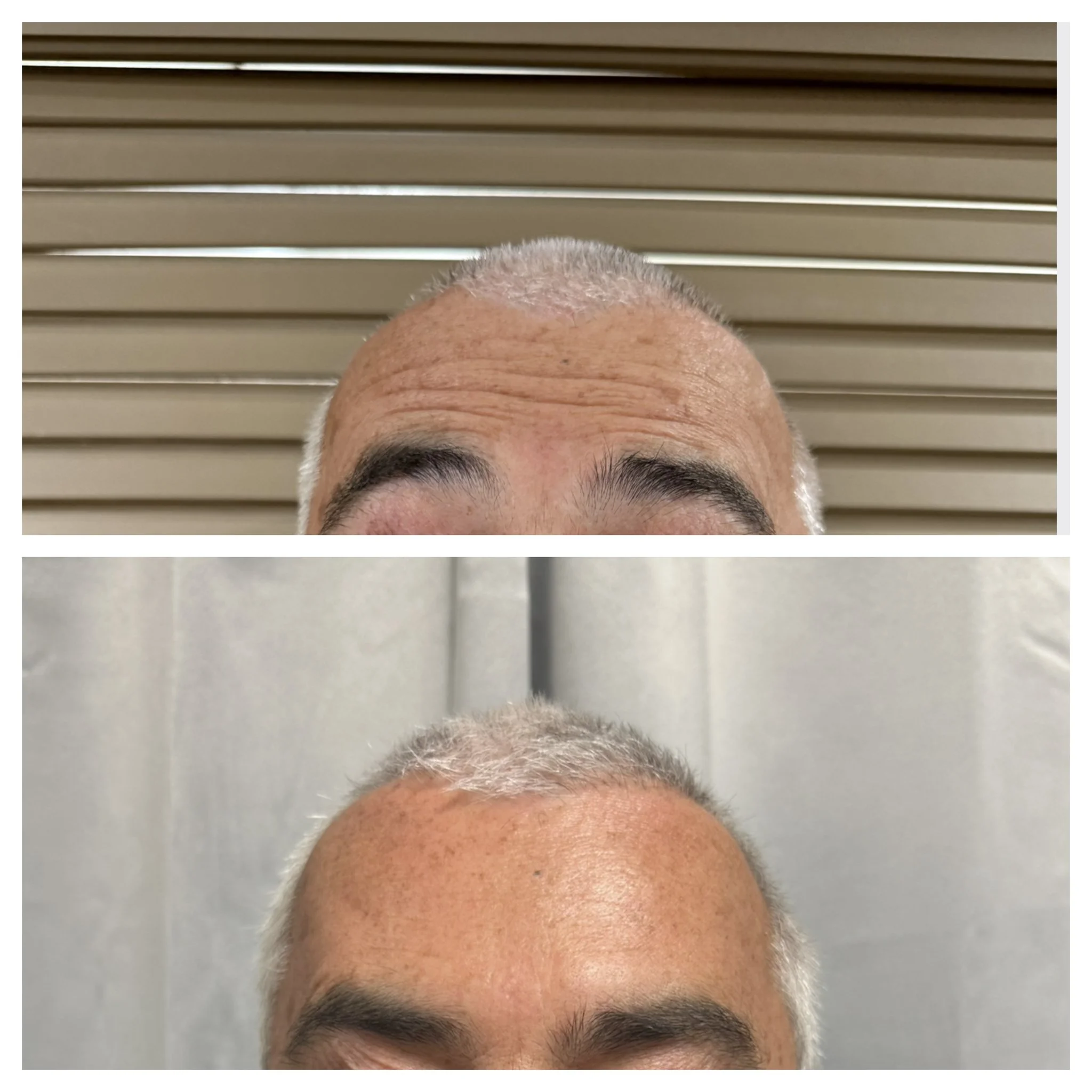 Revalis Aesthetics Medspa in Peoria, AZ, 85381 Botox, Fillers, Weight Loss