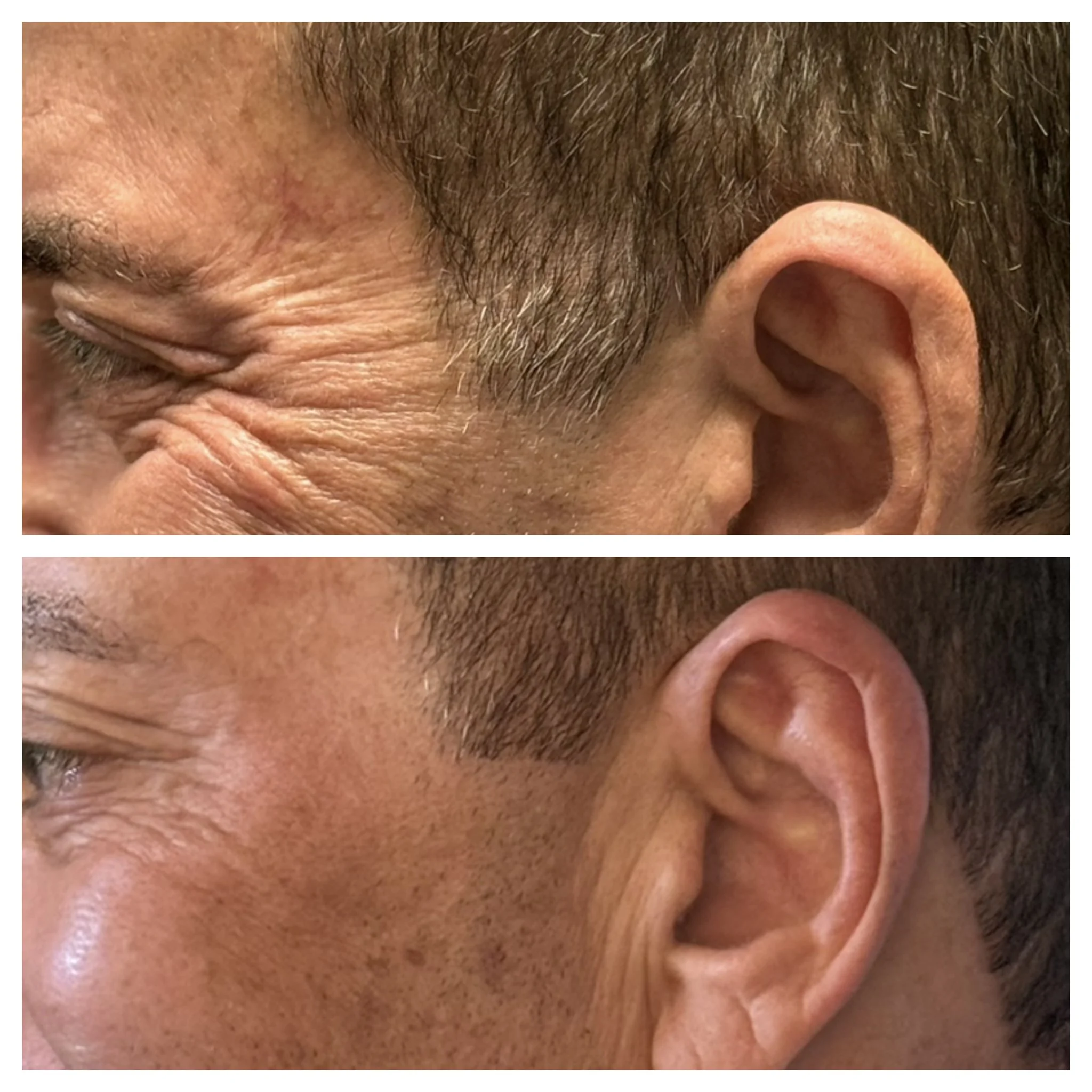 Revalis Aesthetics Medspa in Peoria, AZ, 85381 Botox, Fillers, Weight Loss