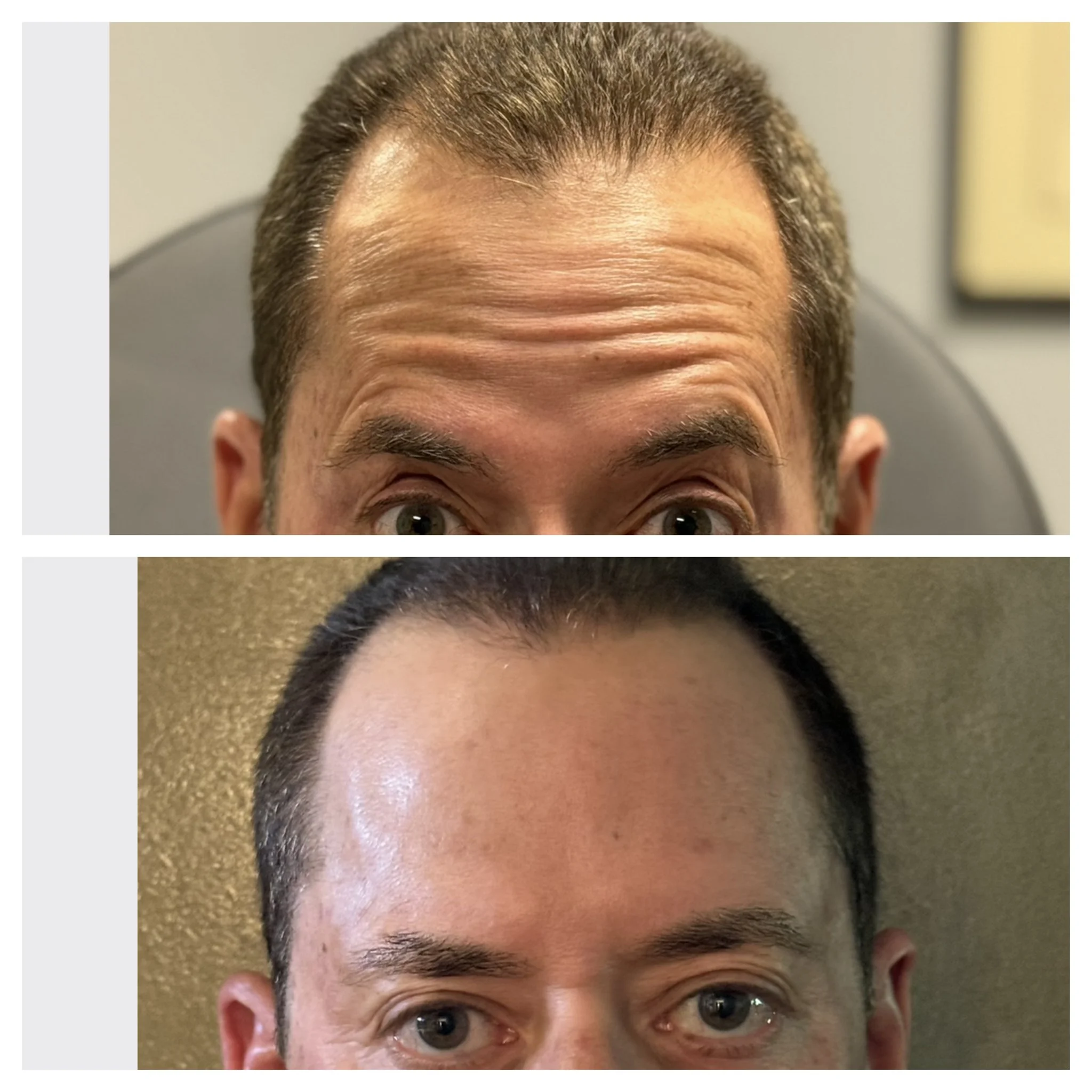 Revalis Aesthetics Medspa in Peoria, AZ, 85381 Botox, Fillers, Weight Loss