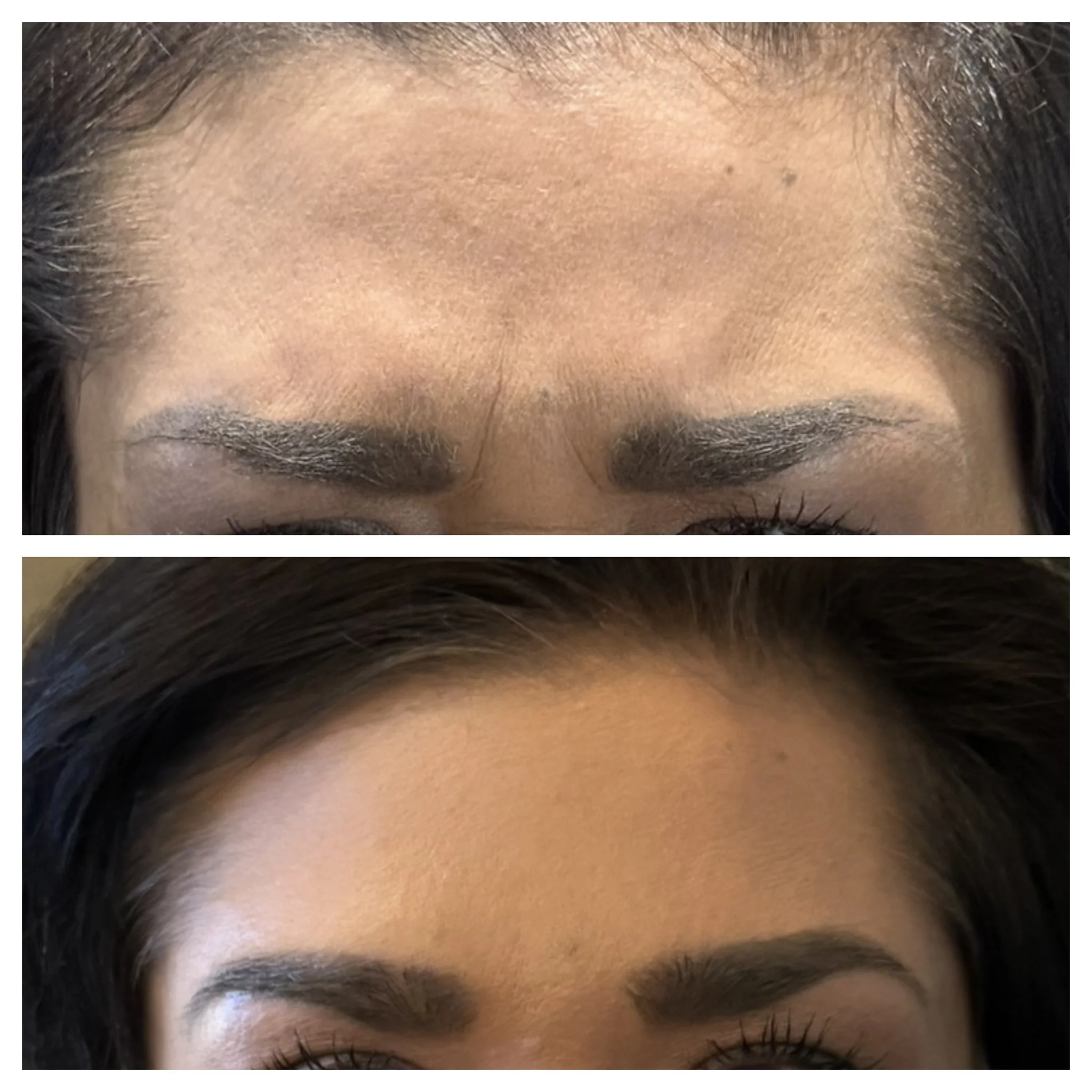 Revalis Aesthetics Medspa in Peoria, AZ, 85381 Botox, Fillers, Weight Loss