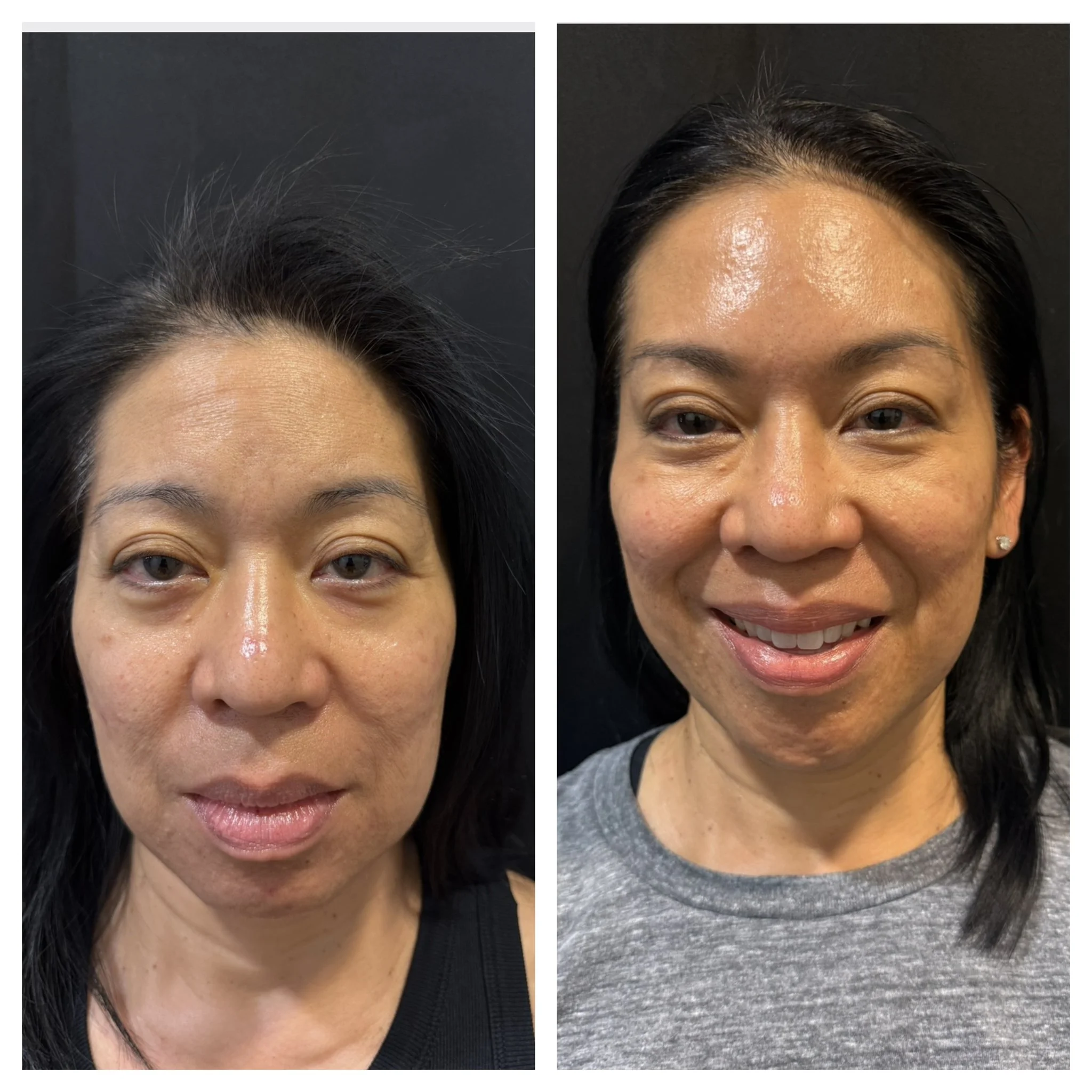 Revalis Aesthetics Medspa in Peoria, AZ, 85381 Botox, Fillers, Weight Loss