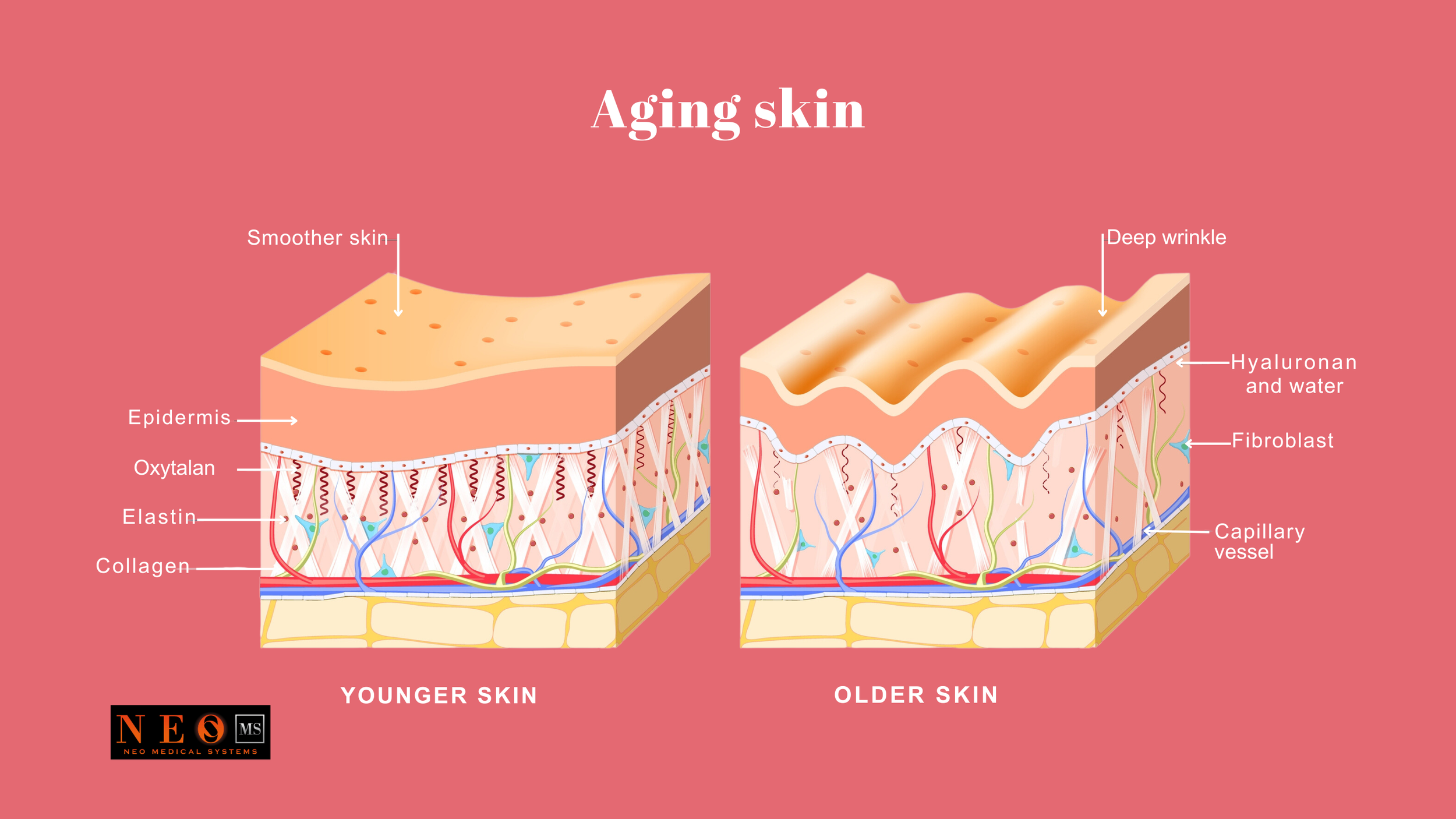 Full body red light therapy anti-aging skin process