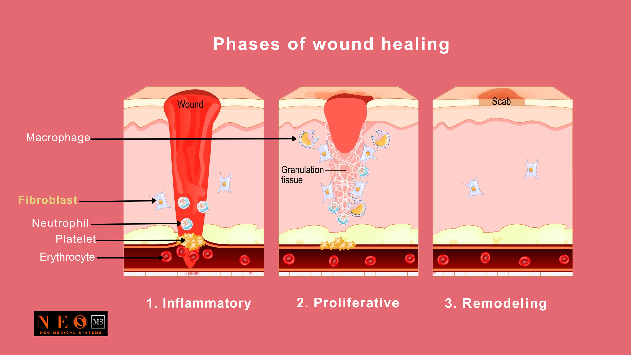 Full body red light therapy anti-inflammatory process