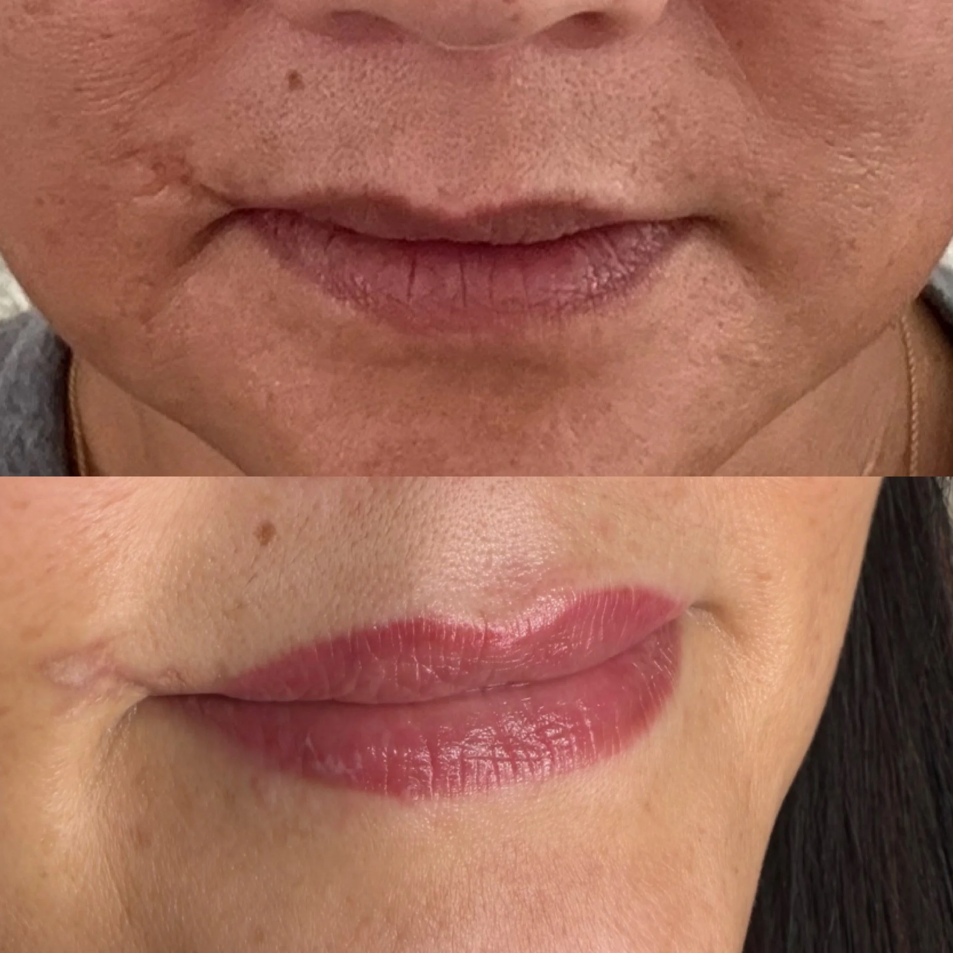 Dark lip color correction at Kinesis Studio in Fairfield CT