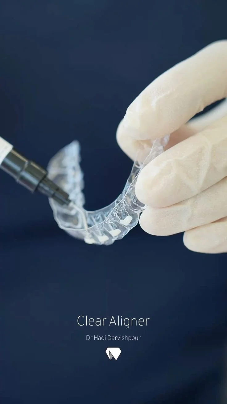 Schiene mit transparentem Clear Aligner und einer Hand in einem weißen Handschuh, die den Aligner hält.