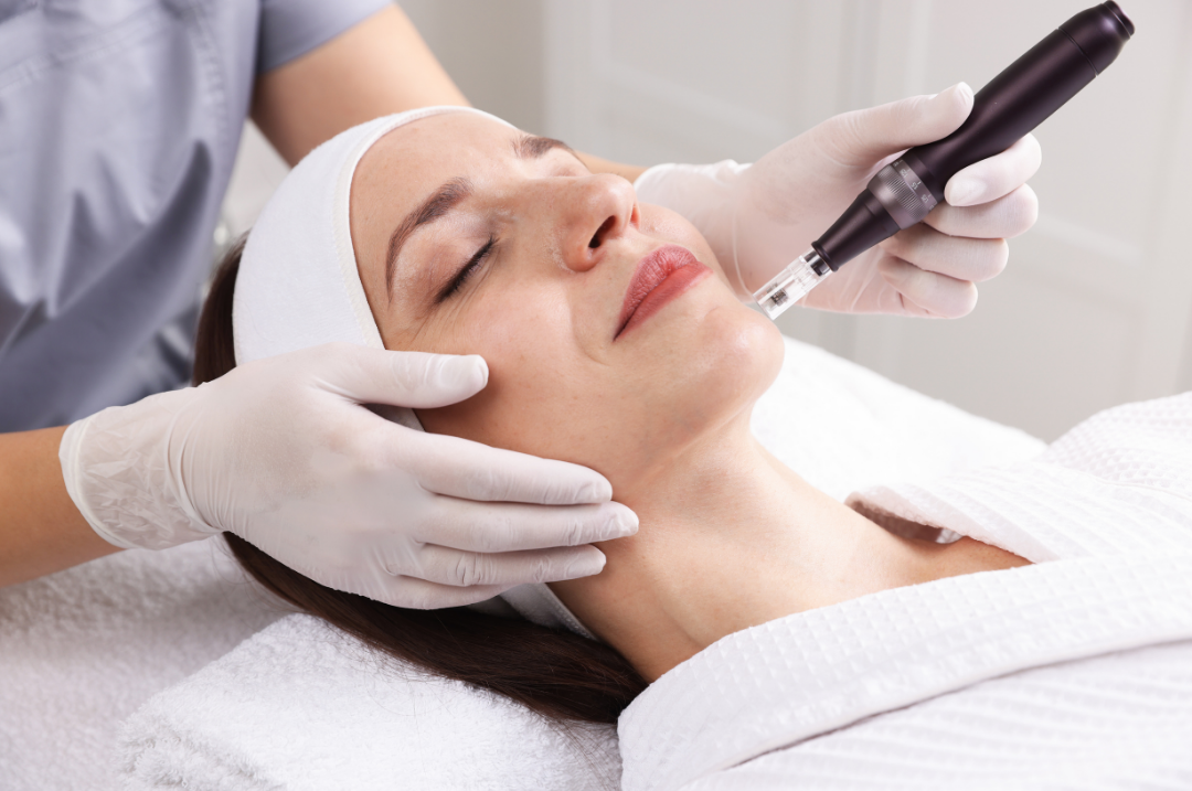 Medspa in Chula Vista, CA, 91914 | Microneedling Near Me