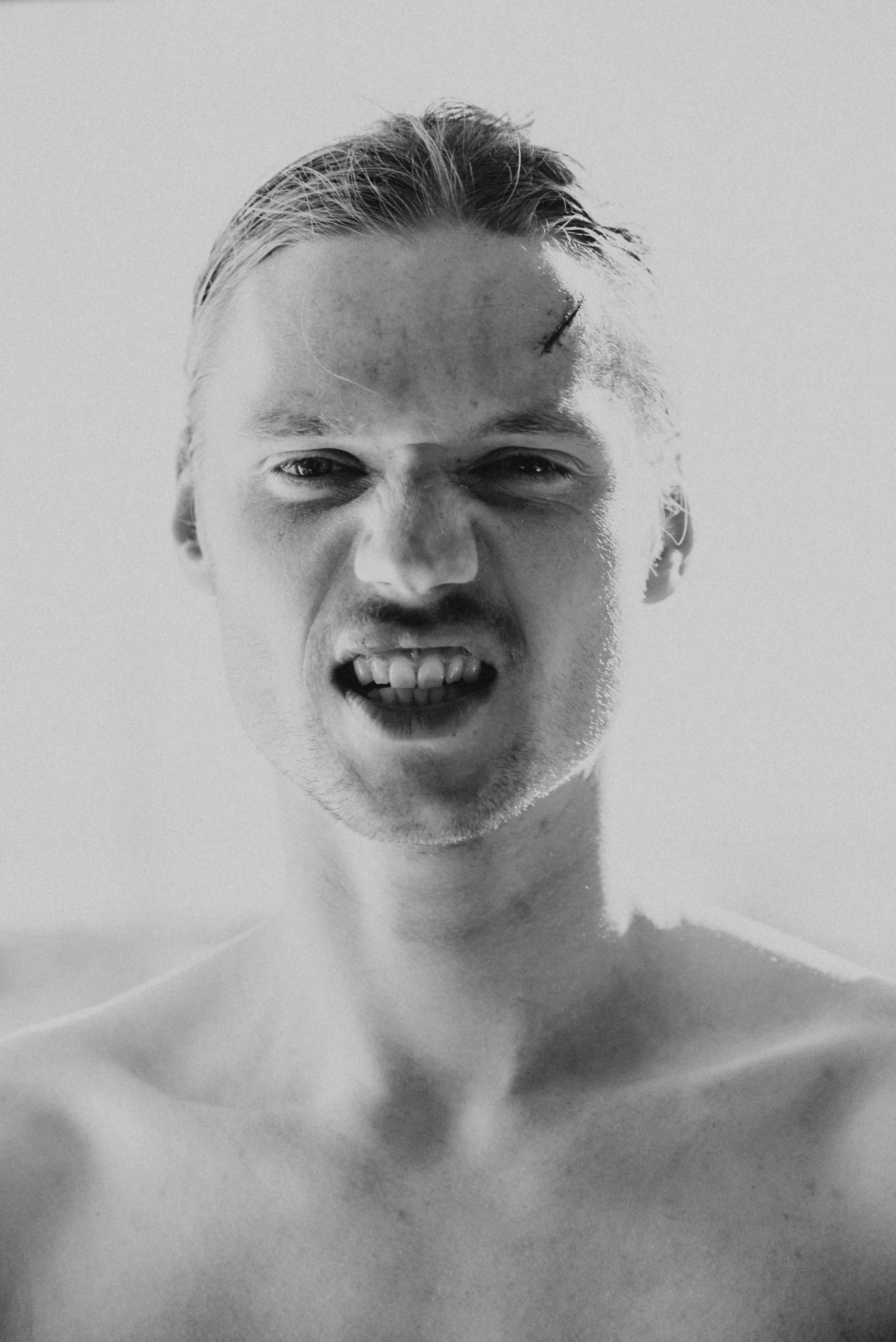 A black-and-white photo of a young man with slicked-back hair making an angry facial expression, showing clenched teeth and scrunched nose.