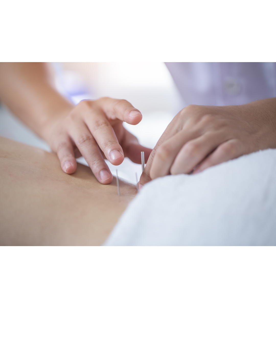 Acupuncture for PMS and Irregular Cycles in Williamsburg