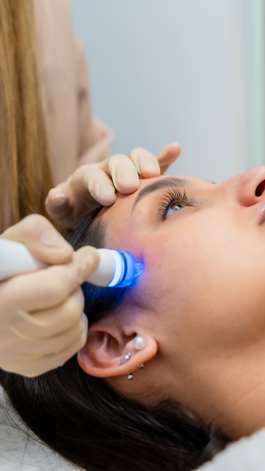 A woman receiving a cosmetic or dermatological treatment on her face with a handheld device emitting blue light, while a professional gently holds her forehead.