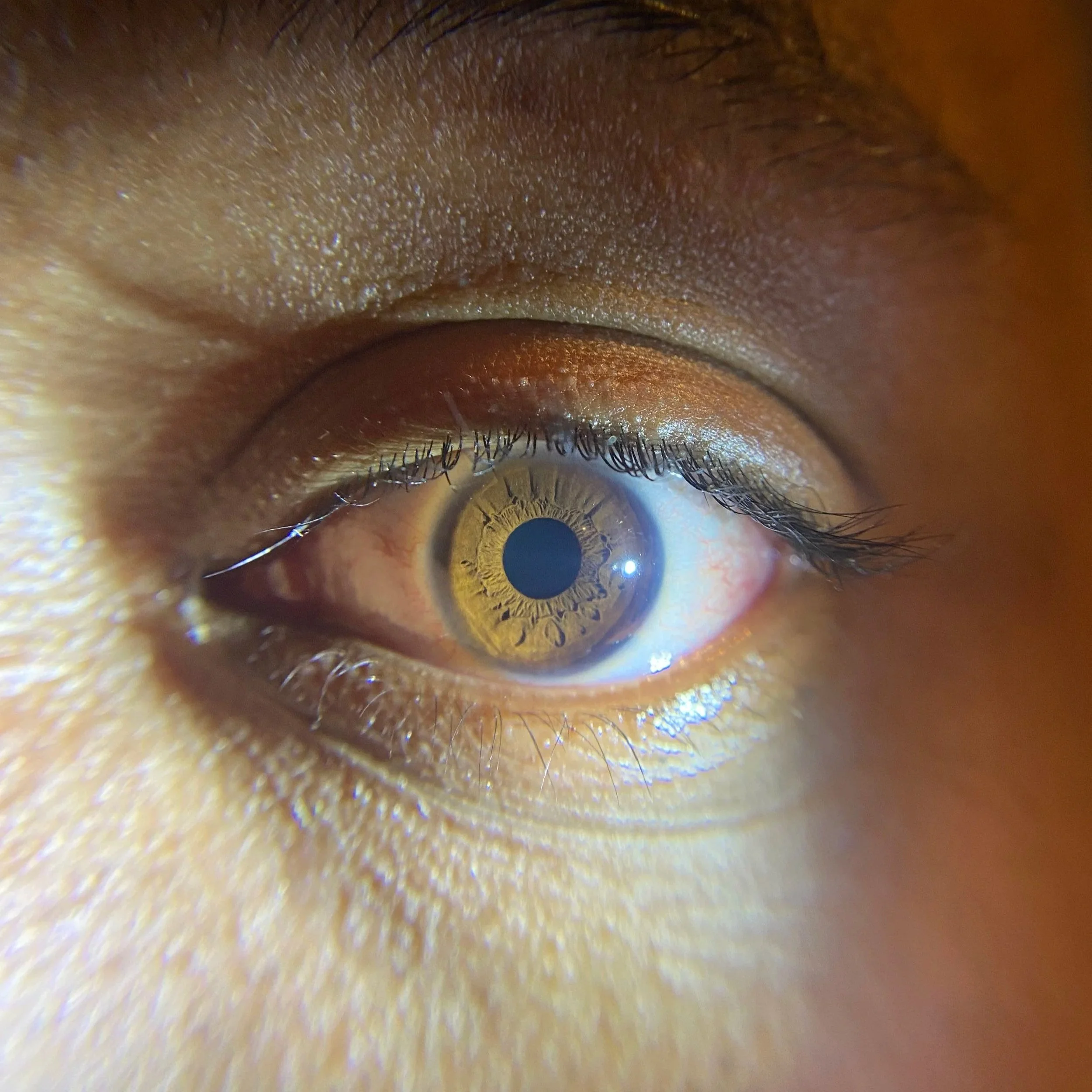 Mini Iris Analysis