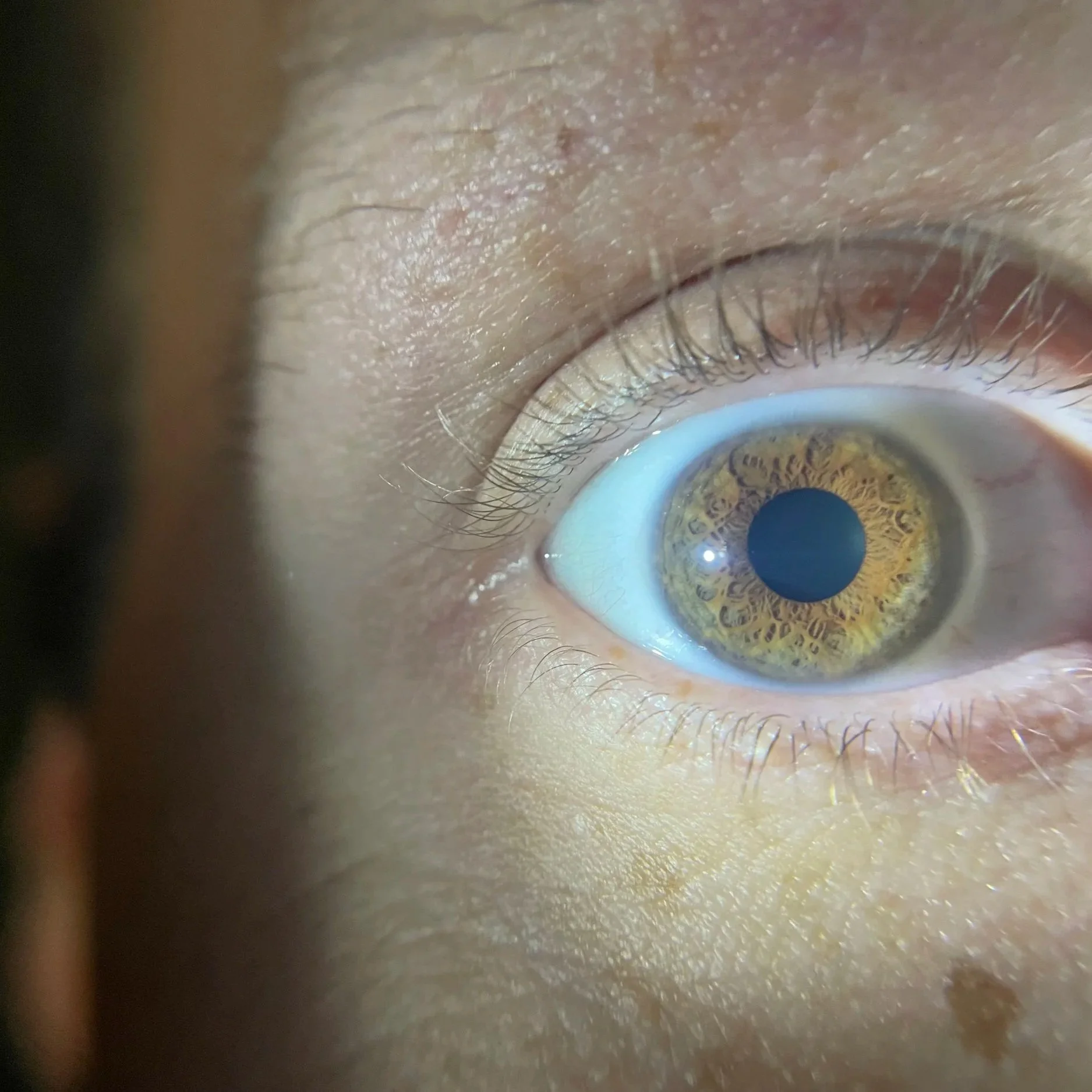 Complete Iris Analysis