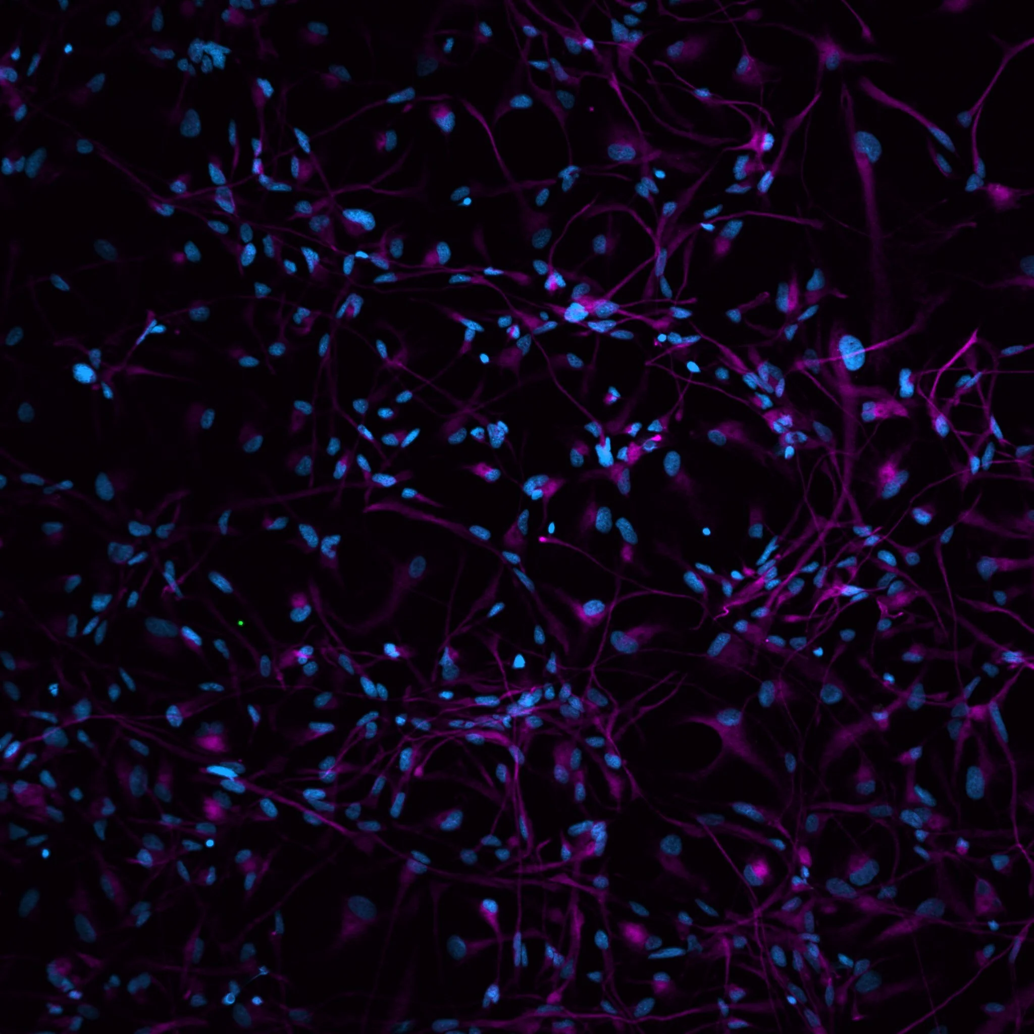 active human NSC, blue DAPI, pink Nestin (©G. Scaravillo)