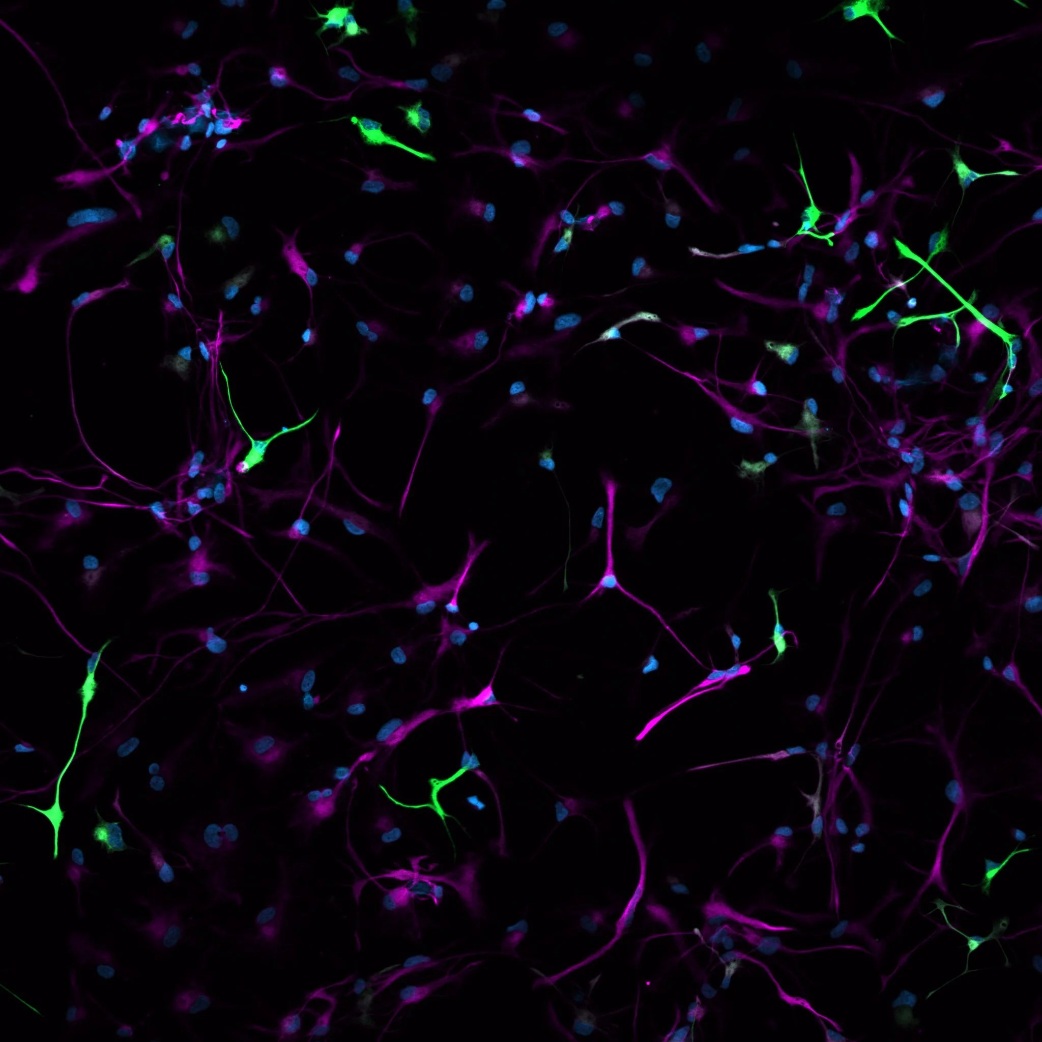 quiescent human NSC, blue DAPI, pink Nestin, green GFAP (©G. Scaravillo)