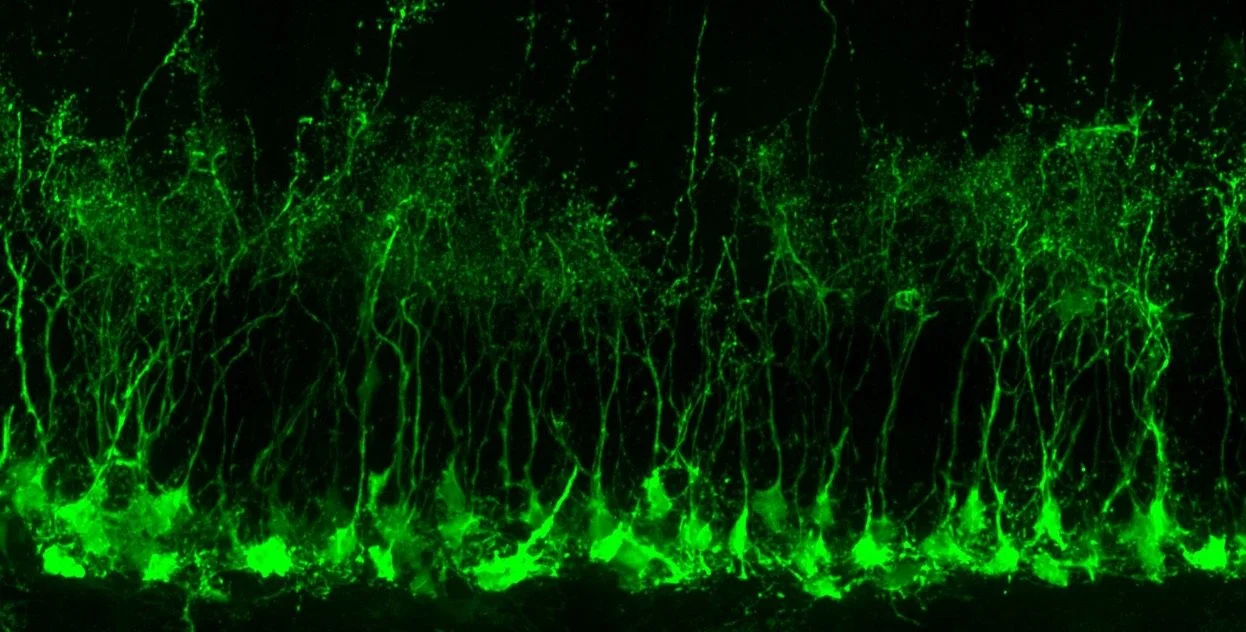 adult hippocampal mNSC, Lfng-GFP reporter (©J. Kleifeld)