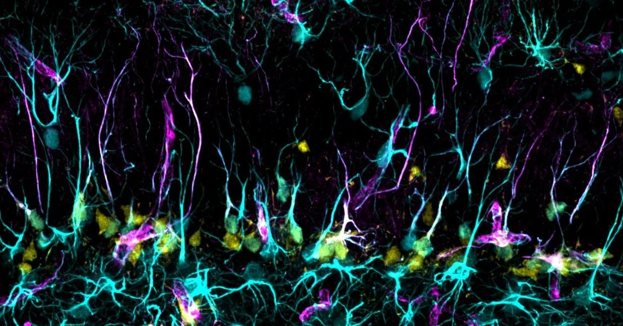 IGF1R cKO mNSCs and astrocytes (©J. Kleifeld)