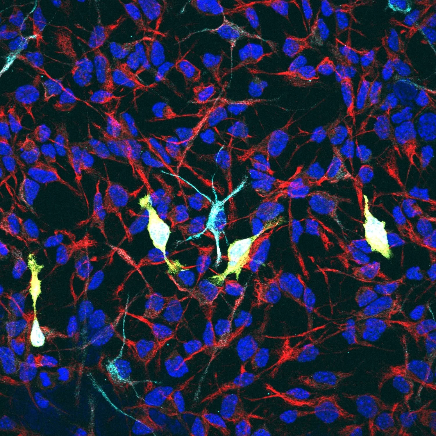 Signaling Pathways