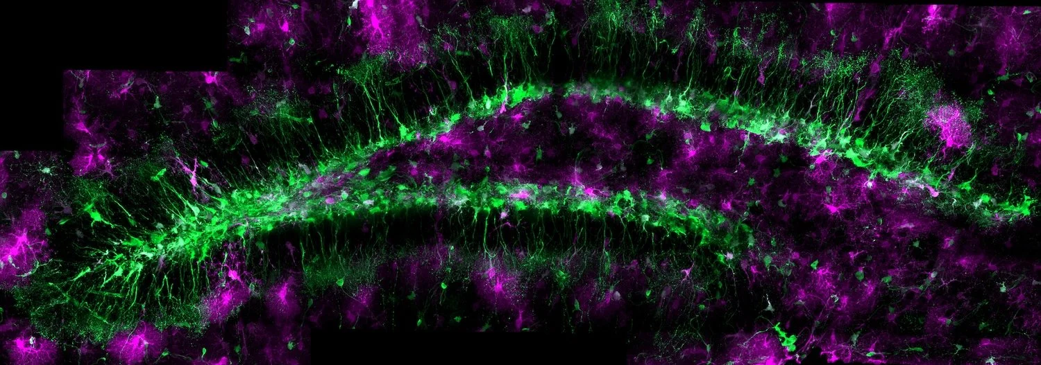 mNSC in the adult DG, NSC in green and astrocytes in magenta (©J. Kleifeld)